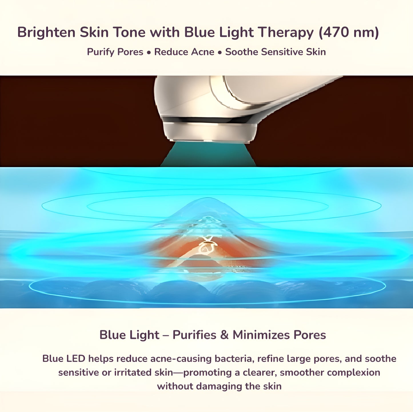 Omrix Radiance Pro
