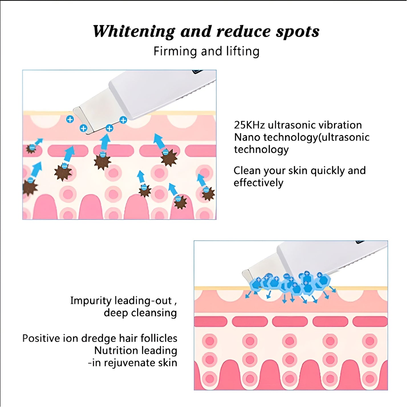 Omrix GlowSonic Exfoliator