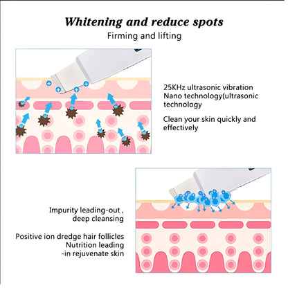 Omrix GlowSonic Exfoliator